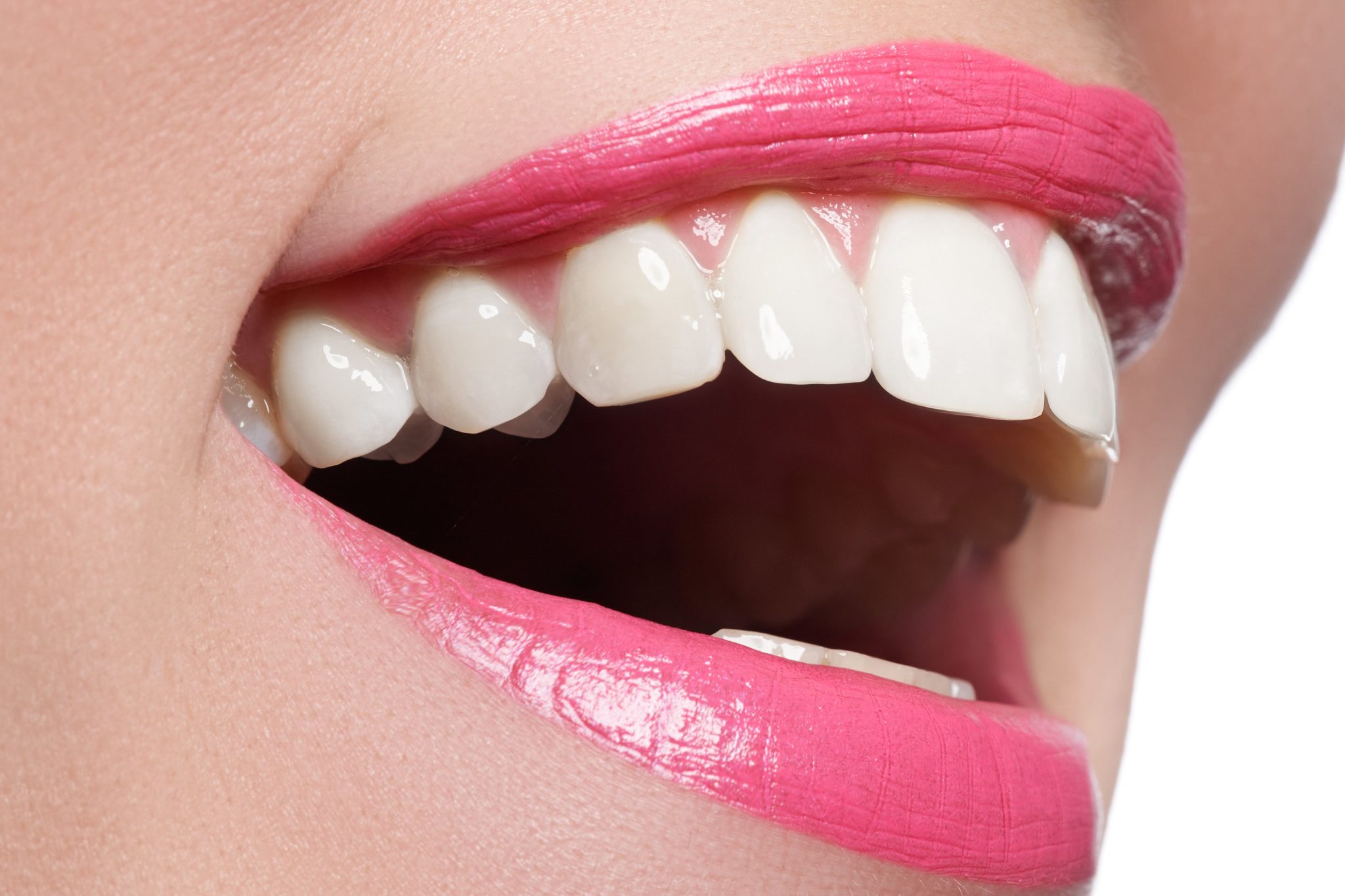 How do I whiten my teeth? The first step.