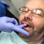 We are using Massad Edentulous Impression Tray by Caulk Densply.