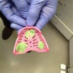 First step, getting the tissue stops. Massad Edentulous Impression Tray.
