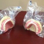 The dentures are returned to us in wax. Today’s visit is to verify all our choices. Are we happy where the teeth are placed? Are we happy with the color? These are the permanent teeth, but everything else is still in wax. We can still change and modify, if necessary. Again, we want to give Eliason Dental Lab a shout out for helping us with this project: Eliason Dental Lab, 190 Riverside St., Unit 6B. Portland, ME 04103 (207) 774-7881 https://www.eliasonlab.com