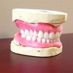 This is the way the denture looks like in wax; tooth color is shade A1. Mike’s visit is scheduled today.