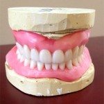 This is the way the denture looks in wax. It has an ideal overjet/overbite, and the tooth color is shade A1.