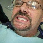 We visually check to see how the denture looks, from a different angle.