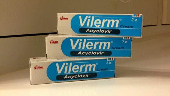 Cold sores, Acyclovir and amazon.com