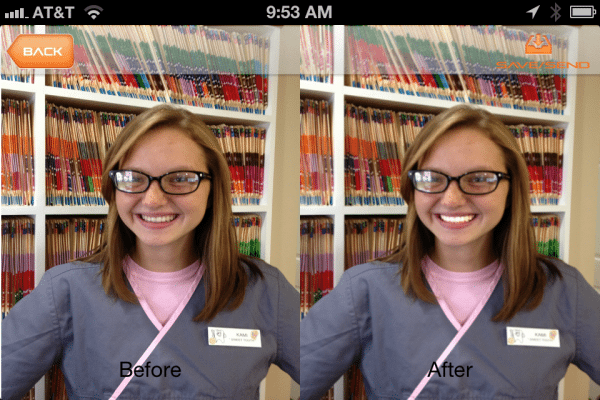 Tooth Whitening – We have an app for that.