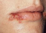 Looking for Lumps and Bumps