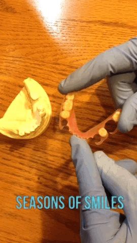Flexing a valplast partial denture.