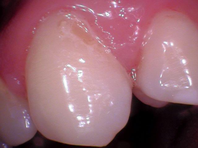 Is my saliva acidic?