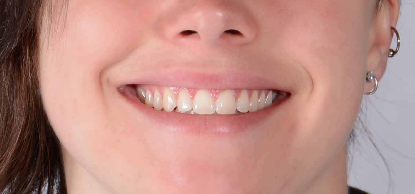Teeth - The Ultimate accessories.