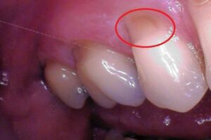 Are your teeth sensitive?