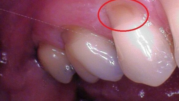 Are your teeth sensitive?