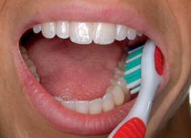 Correct Brushing