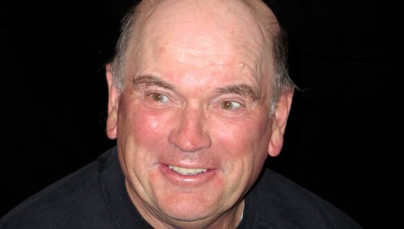 Bill Curtis has a Smile Makeover