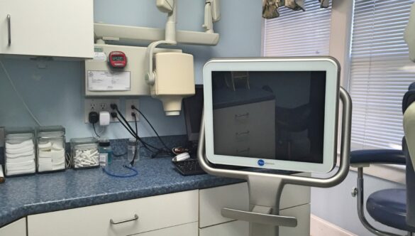 The iTero Scanner