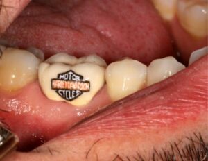 Harley Davidson 4 Me Tooth Tattoo