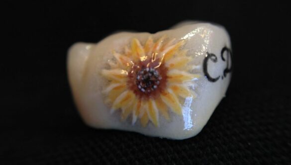 Is there really such a thing as a tooth tattoo?