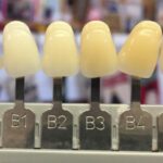 Vita Shade Guide (B Family) (Reddish-Yellowish)