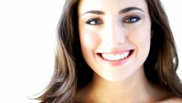 Straight talk about crooked teeth