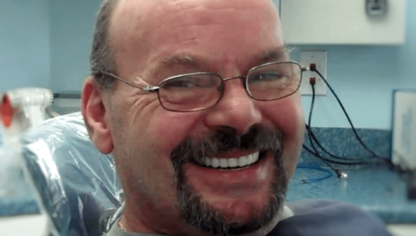 Dentures – Frequently Asked Questions FAQ – Conclusion