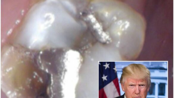 Donald Trump, deregulation, and mercury at the dental office.