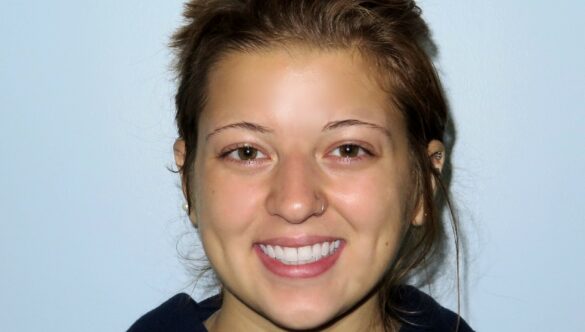 Raccoons, rabies and a follow up dental visit with Rachel Borch