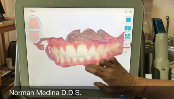 What is a Dental Health Scan? Do I have one in my dental records?