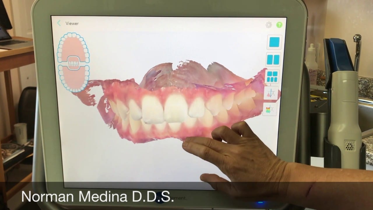 What is a Dental Health Scan? Do I have one in my dental records