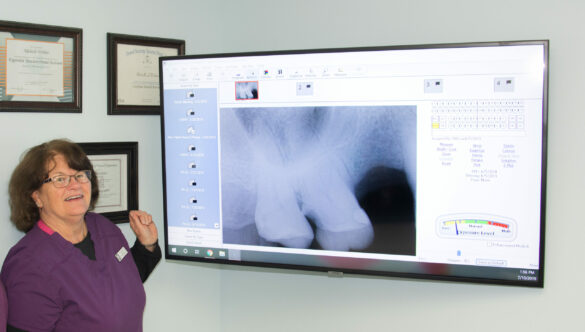 Exploring the Advantages of Digital X-rays