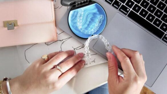 Have you thought of joining the Invisalign Family?