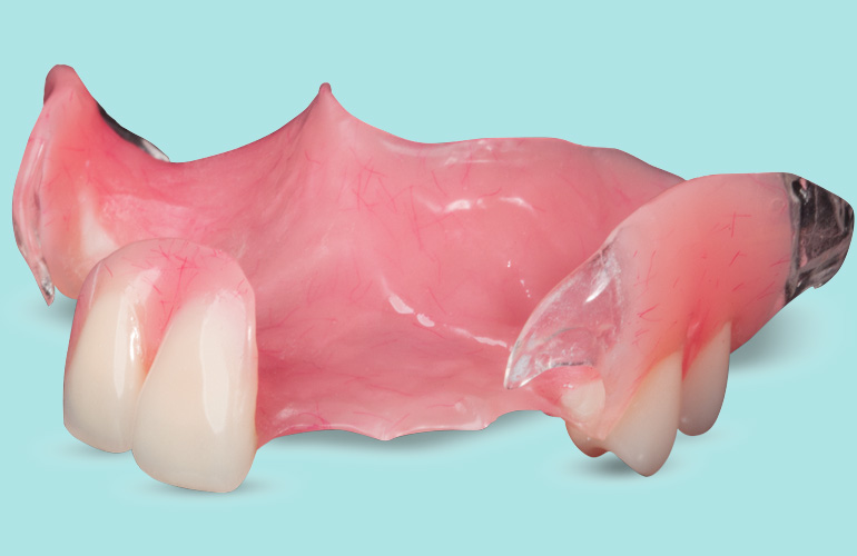 Achieving Aesthetic Excellence with MetalFree Partial Dentures