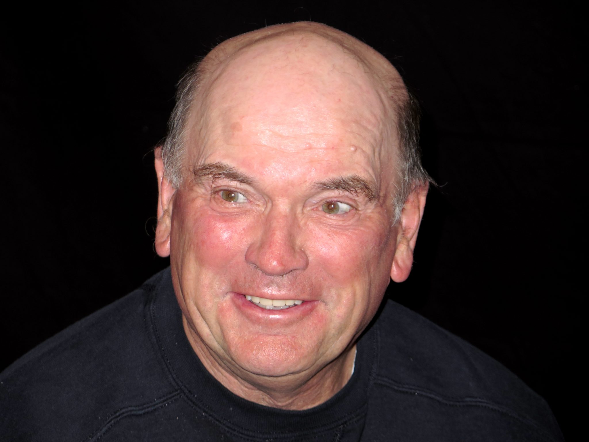 Bill Curtis has a Smile Makeover