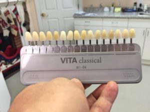 Classic Vita Shade Guide - Tools to whiten my teeth.