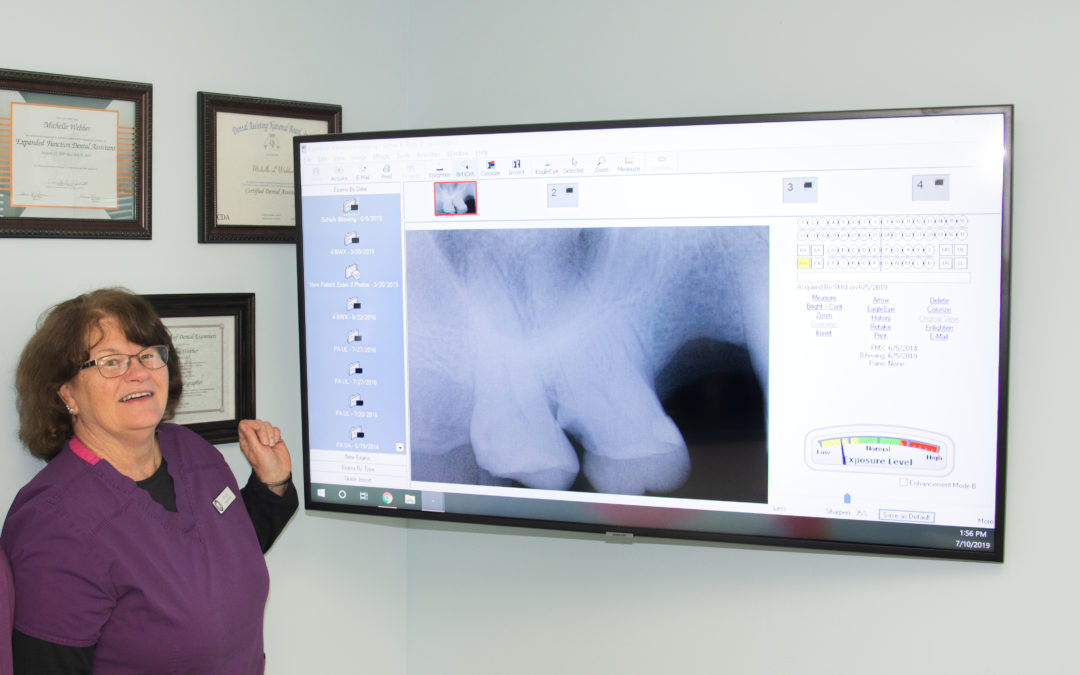 Exploring the Advantages of Digital X-rays
