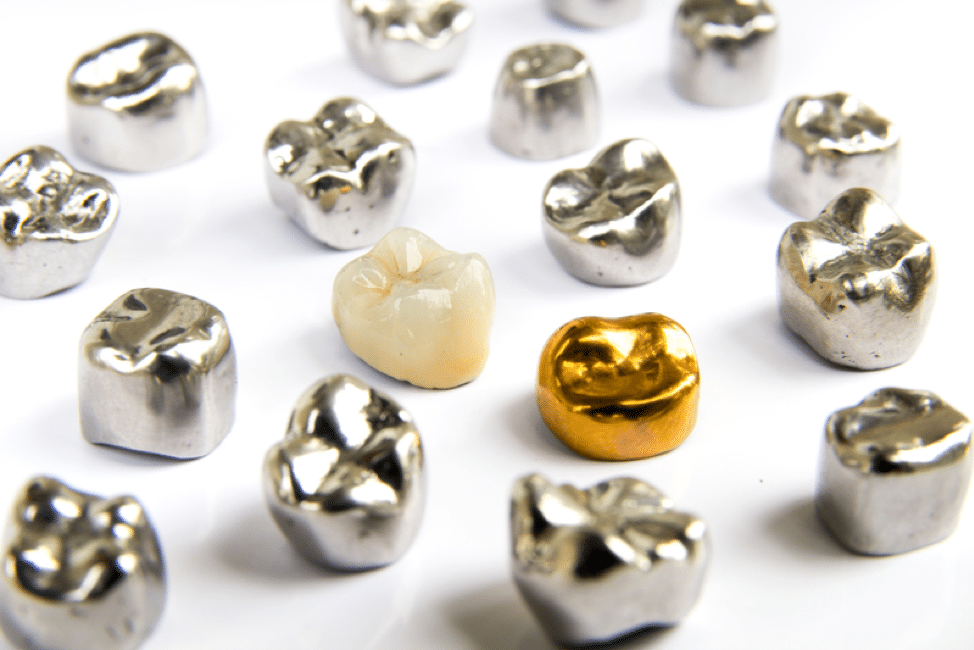 BuildMyContent: 3 Benefits of Dental Crowns