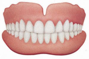 Conventional Complete Dentures - PatientSmart
