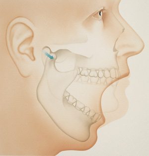 Temporomandibular joint (TMJ)