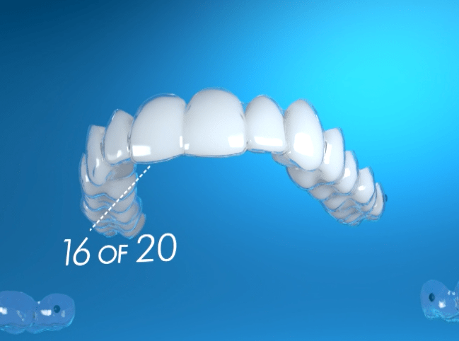 How do Invisalign Aligners Work