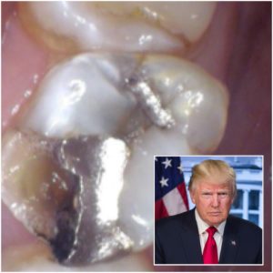 Donald Trump, deregulation, and mercury at the dental office.