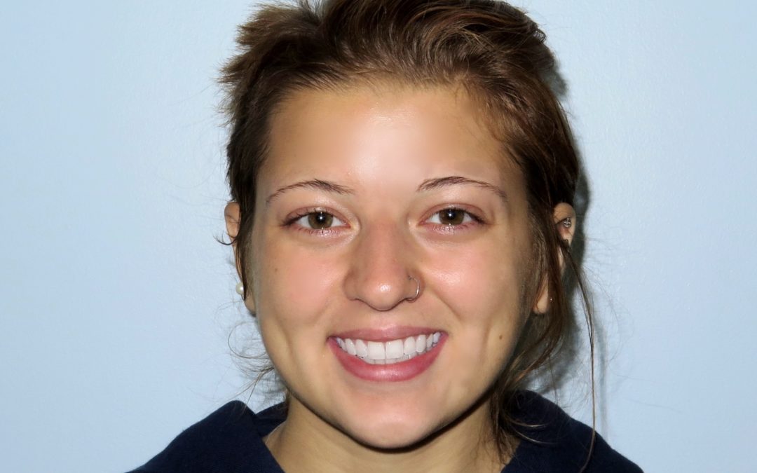 Raccoons, rabies and a follow up dental visit with Rachel Borch