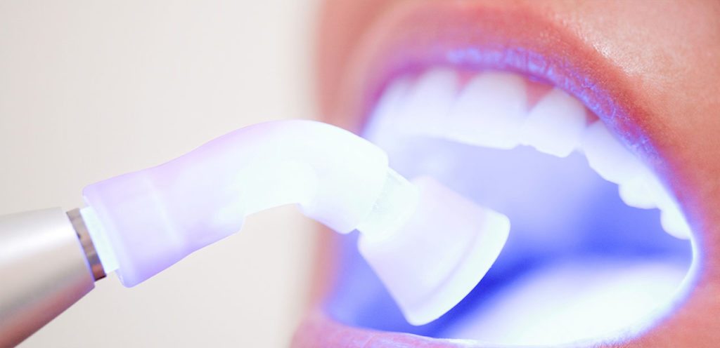 Female patient in dental office receiving Tooth Whitening drying procedure.